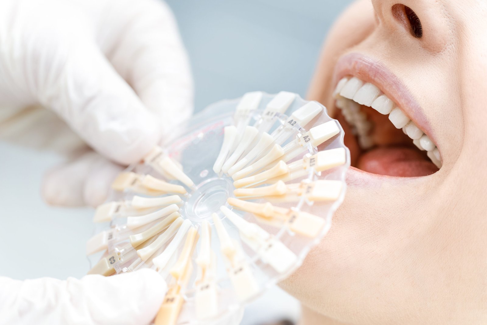 Close-up partial view of dentist comparing teeth of patient with samples