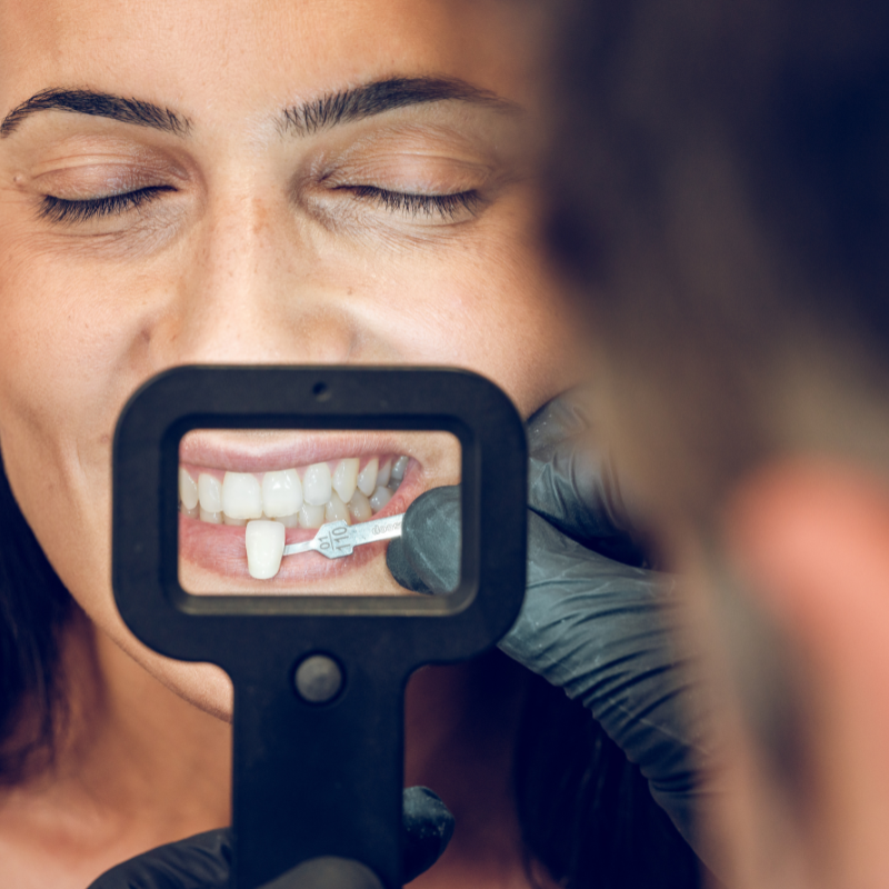 opseis-ritinis-hellinicondental