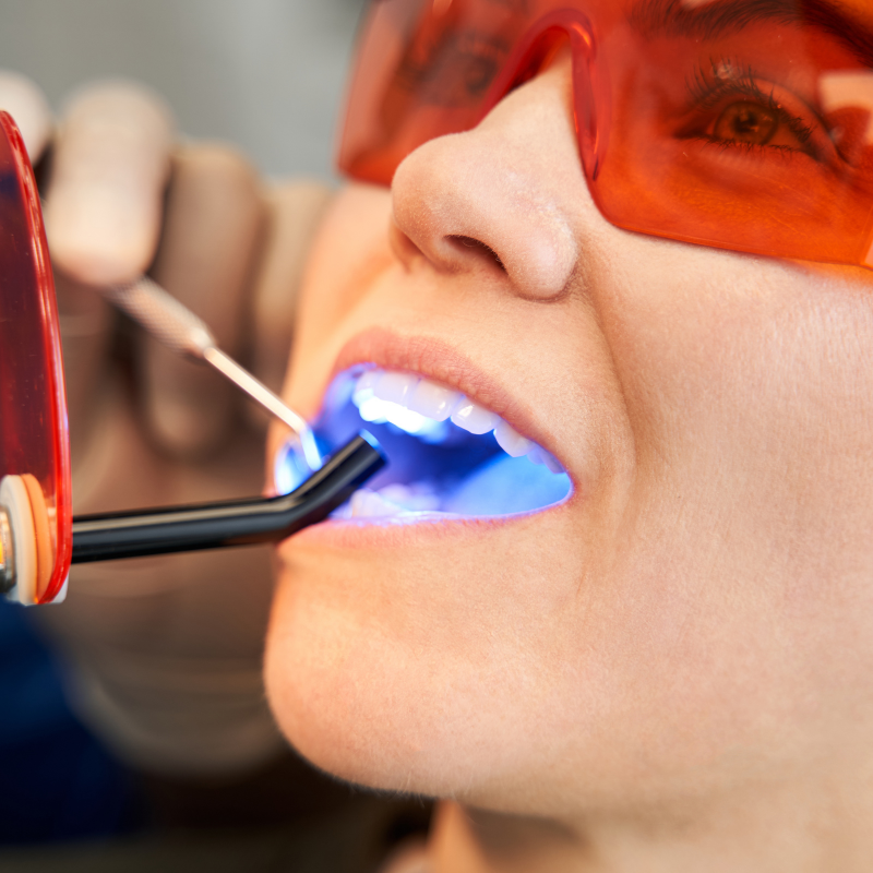 sfragisma-dontion-me-laser