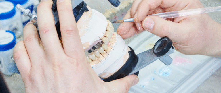 Γέφυρα ή Εμφύτευμα Δοντιού; Ποιο να Επιλέξετε