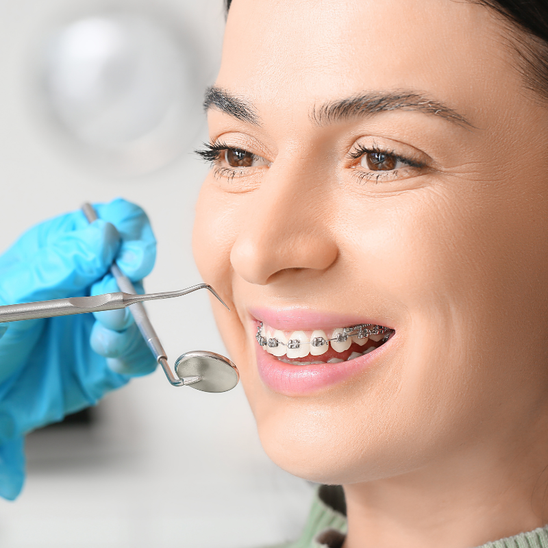 συγχρονες-ορθοδοντικες-θεραπειες