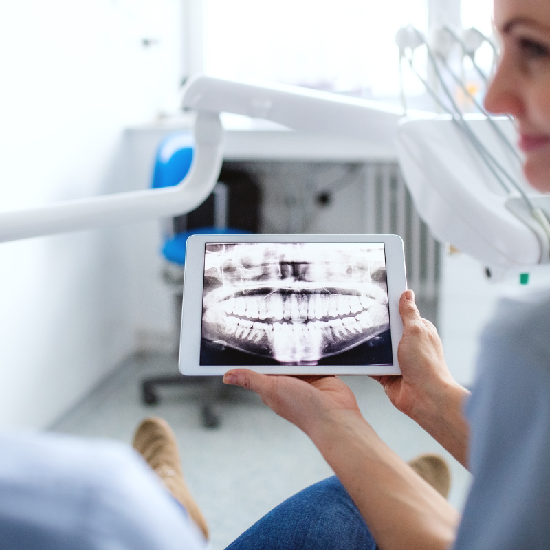 ψηφιακη-ακτινογραφια